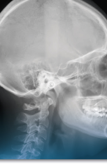 Cirugía Endoscópica de la Nariz, Senos Paranasales y de la Base del Cráneo